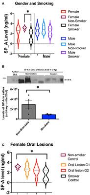 Surfactant Protein A and Microbiome Composition in Patients With Atraumatic Intraoral Lesions